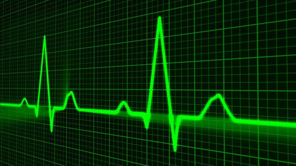 State-of-IT-heart cardiogram