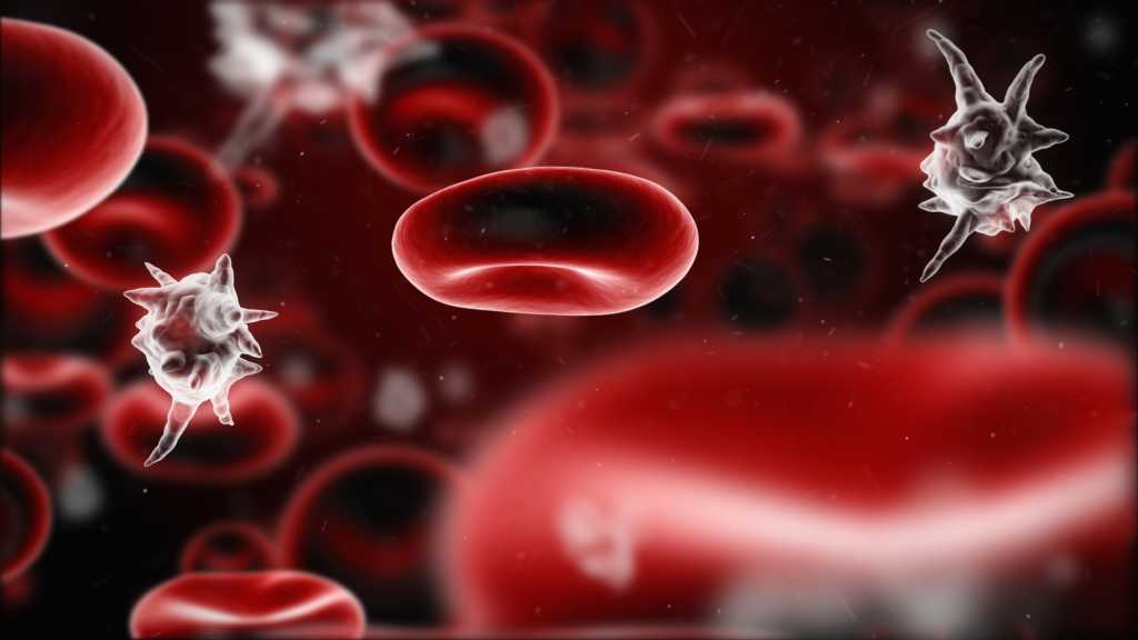 sepsis